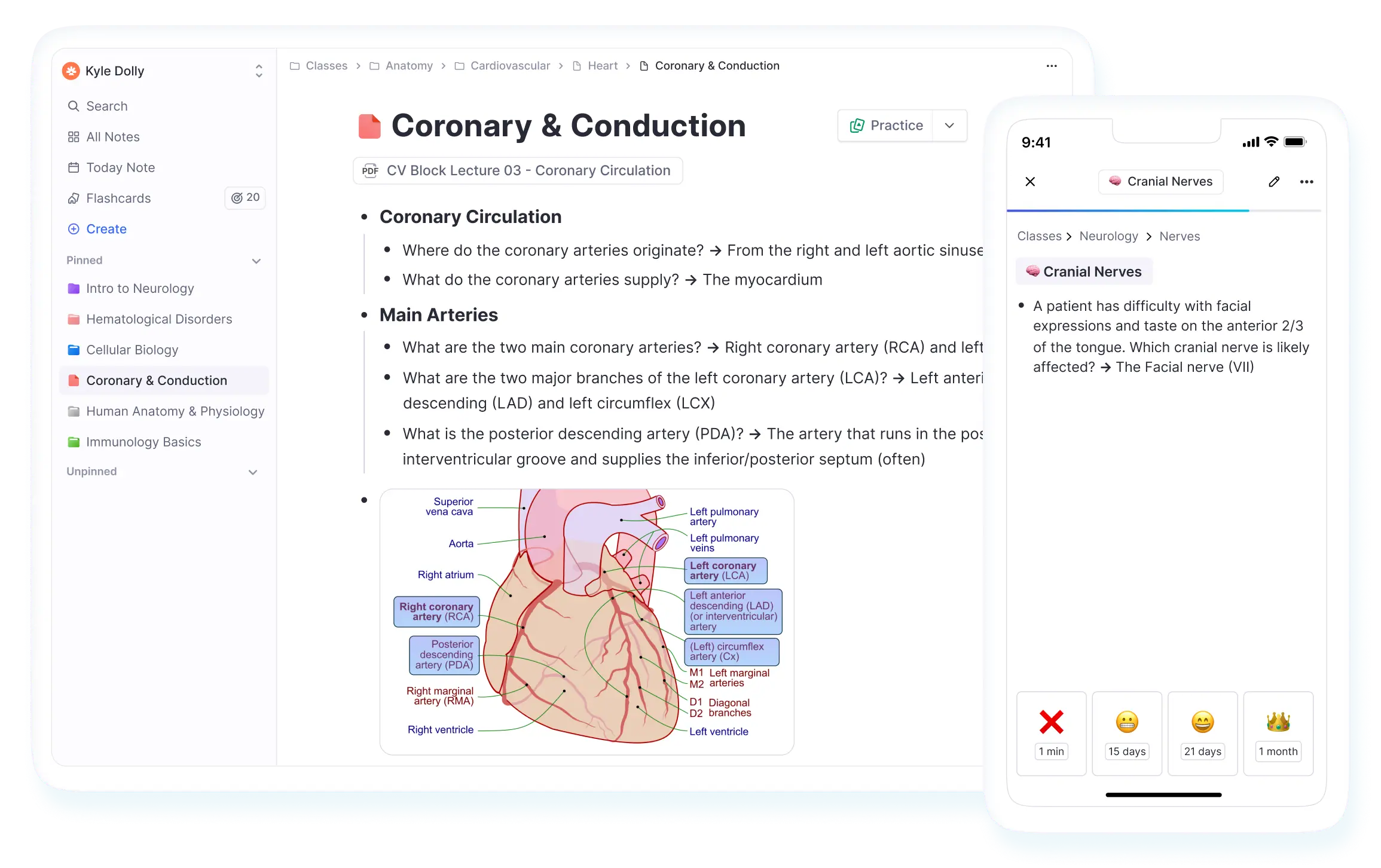 RemNote Notes plus flashcards actual UI screenshot